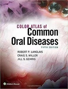 Color Atlas of Common Oral Diseases