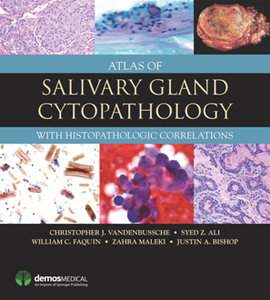 Atlas of Salivary Gland Cytopathology : With Histopathologic Correlations