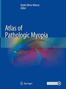 Atlas of Pathologic Myopia