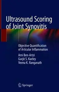 Ultrasound Scoring of Joint Synovitis: Objective Quantification of Articular Inflammation (Repost)
