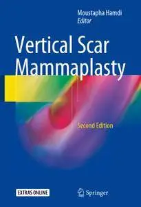 Vertical Scar Mammaplasty, Second Edition