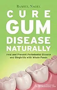 Cure Gum Disease Naturally: Heal and Prevent Periodontal Disease and Gingivitis with Whole Foods [Kindle Edition]