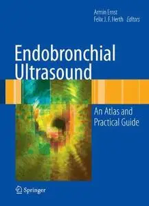 Endobronchial Ultrasound: An Atlas and Practical Guide (Repost)