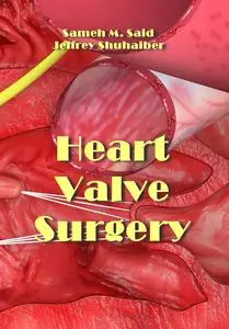 "Heart Valve Surgery" ed. by Sameh M. Said, Jeffrey Shuhaiber