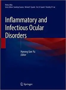 Inflammatory and Infectious Ocular Disorders