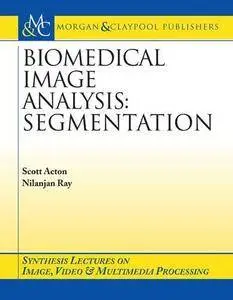 Biomedical Image Analysis: Segmentation (Synthesis Lectures on Image, Video, & Multimedia Processing)
