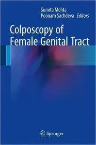 Colposcopy of Female Genital Tract