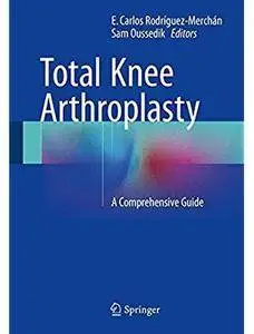 Total Knee Arthroplasty: A Comprehensive Guide [Repost]