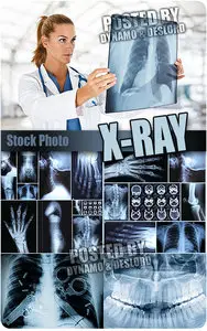 X-ray - UHQ Stock Photo