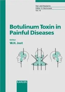 Botulinum Toxin in Painful Diseases (repost)