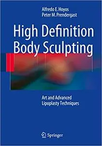 High Definition Body Sculpting: Art and Advanced Lipoplasty Techniques