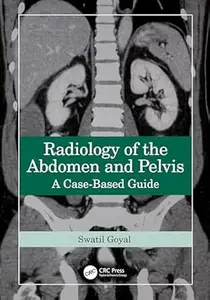 Radiology of the Abdomen and Pelvis