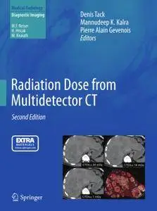 Radiation Dose from Multidetector CT, Second Edition (Repost)