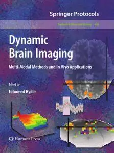 Dynamic Brain Imaging: Multi-Modal Methods and In Vivo Applications (Repost)