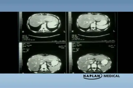 Kaplan USMLE Step 2 – Radiology