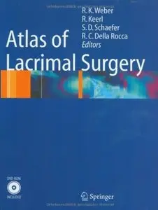 Atlas of Lacrimal Surgery