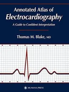 Annotated Atlas of Electrocardiography: A Guide to Confident Interpretation