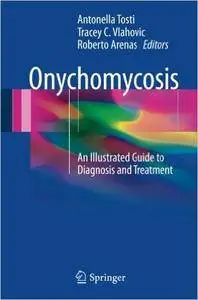 Onychomycosis: An Illustrated Guide to Diagnosis and Treatment (repost)