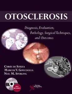 Otosclerosis: Diagnosis, Evaluation, Pathology, Surgical Techniques, and Outcomes (repost)