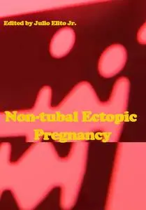 "Non-tubal Ectopic Pregnancy" ed. by Julio Elito Jr.