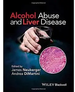 Alcohol Abuse and Liver Disease