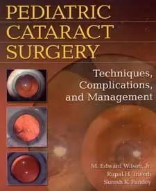 Pediatric Cataract Surgery: Techniques, Complications, and Management (repost)