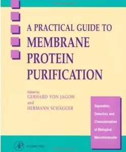 A Practical Guide to Membrane Protein Purification