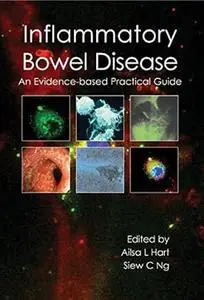 Inflammatory Bowel Disease: an Evidence-based Practical Guide