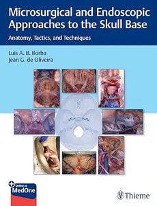 Microsurgical and Endoscopic Approaches to the Skull Base: Anatomy, Tactics, and Techniques (Repost)