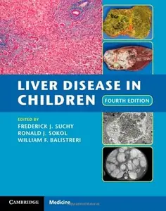 Liver Disease in Children