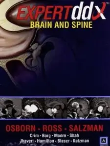 Expertddx: Brain and Spine