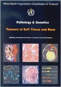 Pathology and Genetics of Tumours of Soft Tissue and Bone by The International Agency for Research on Cancer