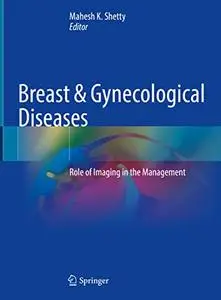 Breast & Gynecological Diseases: Role of Imaging in the Management (Repost)