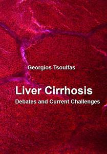 "Liver Cirrhosis: Debates and Current Challenges" ed. by Georgios Tsoulfas