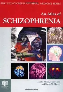 Atlas of Schizophrenia (Encyclopedia of Visual Medicine Series) by Martin Stefan [Repost]