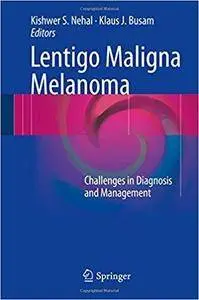 Lentigo Maligna Melanoma: Challenges in Diagnosis and Management