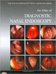 An Atlas of Diagnostic Nasal Endoscopy