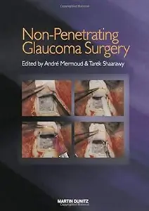 Non-Penetrating Glaucoma Surgery
