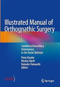 Illustrated Manual of Orthognathic Surgery: Combined Bimaxillary Osteotomies in the Facial Skeleton