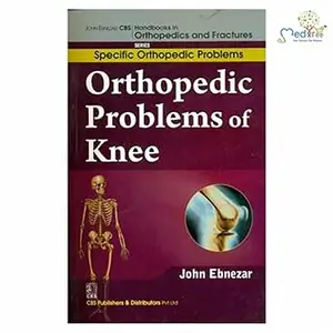 Orthopedic Problems Of Knee
