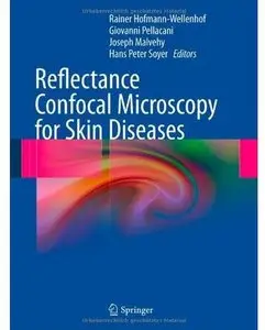 Reflectance Confocal Microscopy for Skin Diseases