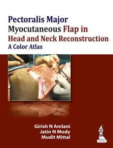 Pectoralis Major Myocutaneous Flap in Head and Neck Reconstruction: A Color Atlas