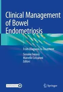 Clinical Management of Bowel Endometriosis: From Diagnosis to Treatment