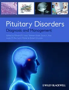 Pituitary Disorders: Diagnosis and Management (repost)