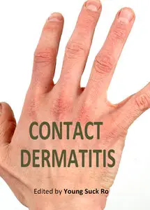 "Contact Dermatitis" ed. by  Young Suck Ro 