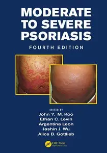 Moderate to Severe Psoriasis, Fourth Edition (repost)