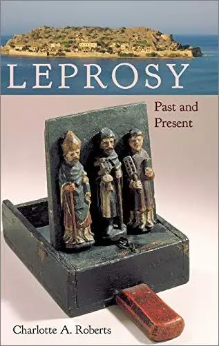 Leprosy: Past and Present