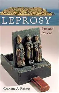 Leprosy: Past and Present