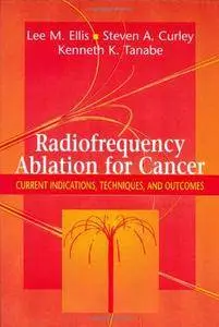 Radiofrequency Ablation for Cancer: Current Indications, Techniques, and Outcomes