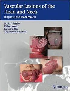 Vascular Lesions of the Head and Neck: Diagnosis and Management